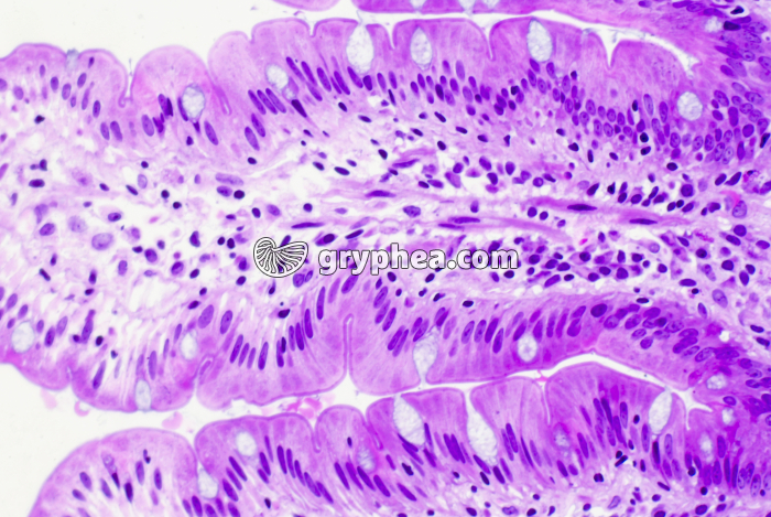 Intestin grêle - muqueuse intestinales, avec entérocytes et cellules caliciformes x120 - gryphea.org